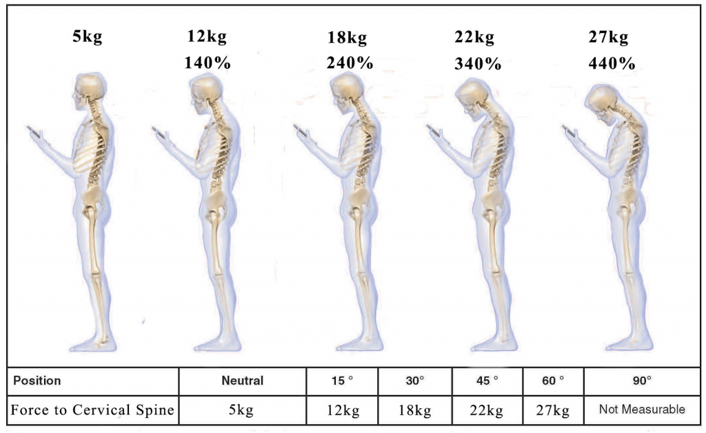 Cycling with a Slipped Disc