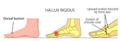 Flint Foot and Ankle Care
